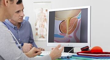diagnostiquer la prostatite chez un homme