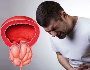 Les symptômes de la prostatite chronique chez les hommes